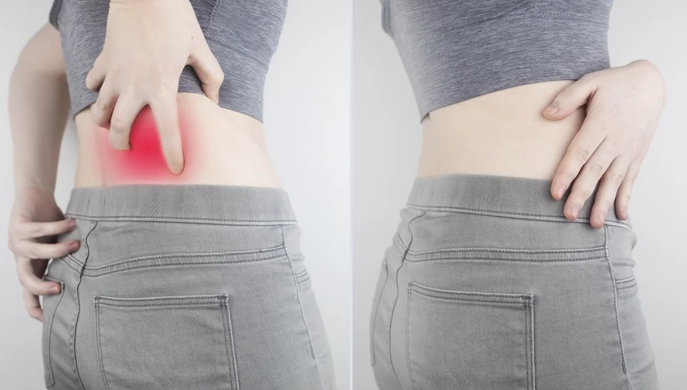 Terapia Física - Nervios pinchados